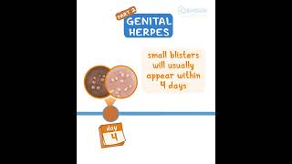 Genital Herpes pt 2 [upl. by Nipsirc131]