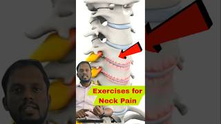 CERVICAL SPONDYLOSIS discbulge exercises physiotherapy [upl. by Nemzaj132]