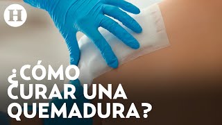 ¿Cómo actuar en caso de quemadura Rodrigo Mata nos comparte tips para reaccionar en esta emergencia [upl. by Ahk305]