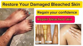 How To Repair Damaged Bleached Skin [upl. by Etnahc]