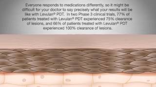 Levulan Patient Education Video [upl. by Eselrahc178]