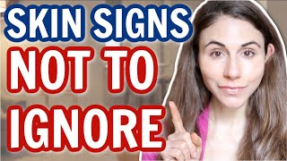 7 SKIN SIGNS NOT TO IGNORE 😮 DERMATOLOGIST DrDrayzday [upl. by Elicul]