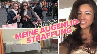 Meine AUGENLIDSTRAFFUNG FMA Teil 23 — Nach der OP [upl. by Yael617]