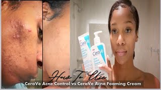 How to use✨ CeraVe Acne Control Cleanser vs CeraVe Acne Foaming Cream Cleanser 🙌🏾 30 Day Review [upl. by Suiratnauq]