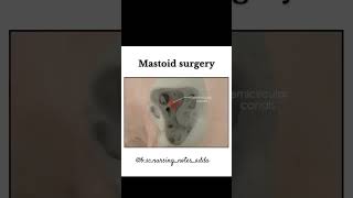 Mastoid surgery procedureanatomy reels hearttouching study youtube ytshorts ytviral [upl. by Codel698]