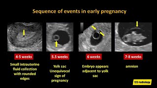 𝐏𝐨𝐬𝐭𝐩𝐚𝐫𝐭𝐮𝐦 𝐇𝐞𝐦𝐨𝐫𝐫𝐡𝐚𝐠𝐞  part 1  Obstetrics amp gynaecology [upl. by Anirbas]