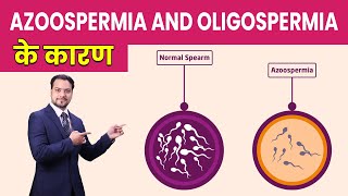 Causes of Azoospermia and Oligospermia  Oligospermia and Azoospermia Treatment Naturally in Hindi [upl. by Sharpe286]