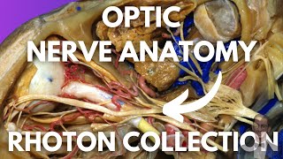 Optic Nerve Neuroanatomy Simplified Rhoton Collection [upl. by Dustie963]