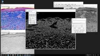 ImageJ  Measuring Areas of Histological sections [upl. by Maximo167]