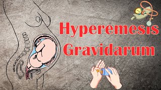 Hyperemesis Gravidarum  Causes Signs amp Symptoms Diagnosis amp Treatment [upl. by Kirby447]