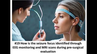 19 How is the seizure focus identified through EEG monitoring and MRI scans during presurgical eva [upl. by Fihsak]