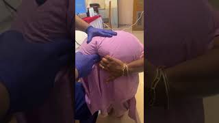 Chiropractor Treatment For Heavy Tailbone Pain mumbai delhi [upl. by Anaic]