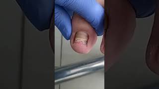 Satisfying Pedicure Video pedicure toenails [upl. by Pich122]