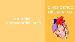 Diagnóstico Diferencial Arritmias supraventriculares [upl. by Ermanno335]