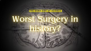 Exploring Sciences Dark Side The Lobotomy – Was It the Absolute Worst Surgery Ever Documentary [upl. by Ecinna]