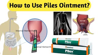 How to Use Piles Ointment [upl. by Aniret]