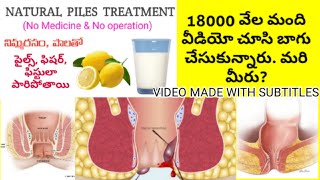 Piles Fissures and Fistula Treatment at Home in Telugu  Telugu Tips [upl. by Ahtennek]