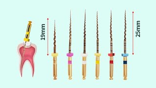 Endodontics Clinical  Rotary Instrumentation Files [upl. by Terrill]