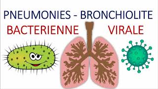 Comment différencier entre une pneumonie aigue communautaire bactérienne et virale atypique [upl. by Niltyak]