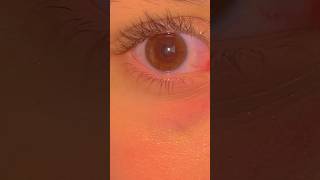 Idk why my eye is so red what color is your eyeeyes trending [upl. by Krisha]