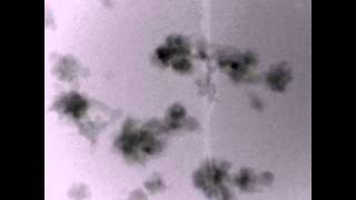 Lithium dendrite formation [upl. by Ora]