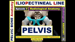 Anatomy 9 Pelvic bone Iliopectineal line Waldenstorm sign Teardrop sign [upl. by Nnylrefinnej]