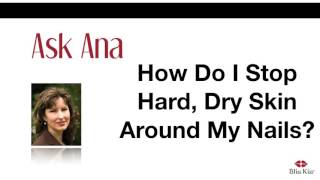 Ask Ana How Do I Stop Hard Dry Skin Around My Nails [upl. by Zebada]