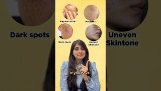 Skincare for Pigmentation and Uneven Skintone  Sunscreen for Pigmented skin  Dark Spots Melasma [upl. by Aiyram]