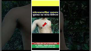 ড্রেসিং করার পরের অবস্থা  Gynecomastia Treatment Bangladesh [upl. by Valli392]