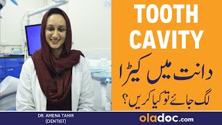 TOOTH CAVITY TREATMENT  Dant Men Keeray Ka Ilaj  Dental Carries Danto Men Cavity Kaise Nikale [upl. by Desiree768]