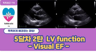 Visual ejection fraction  EF eyeball estimation echocardiography 심장초음파 heart echo view [upl. by Erl522]