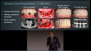 An introduction to the Trefoil system by Dr Kenji Higuchi [upl. by Eirallih772]