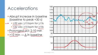 Learn OBGYN Fetal Heart Rate Monitoring  Nonstress Test [upl. by Asset120]