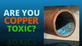 Copper Toxicity  Risk Symptoms and Treatment Strategies [upl. by Spearing192]