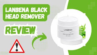 LANBENA Blackhead Remover Review Does It Really Work [upl. by Culberson]