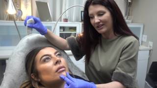 Chin Augmentation using Restylane Lyft for a Heart Shaped Face [upl. by Leonerd]