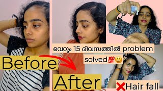 ഇത്രയും വേഗം result പ്രതീക്ഷിച്ചില്ല😳😱works like a Killadi🥸haircare hairserum wishcarehairgrowth [upl. by Elenaj995]