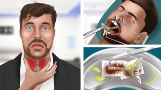 ASMR Animation Help MrBeast remove fish bones stuck in his throat [upl. by Liahkim]