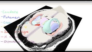 Basal Ganglia 3D Tour [upl. by Winna]