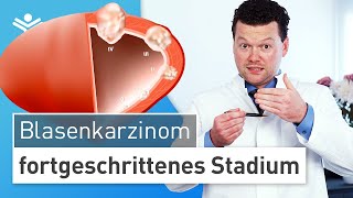 Blasenkrebs im fortgeschrittenen Stadium Wann muss die Blase entfernt werden [upl. by Ola]