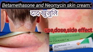 Betamethasone and Neomycin skin cream use in nepalibetnovate n cream useurticariapsoriasis treat [upl. by Abbe]