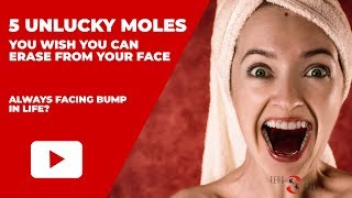 Unlucky Moles Position On Your Face  Facial Mole Reading Physiognomy [upl. by Fabrienne]