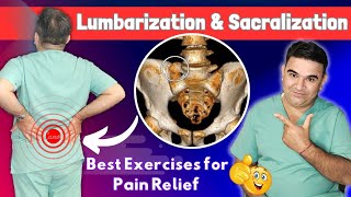 Unlocking Low Back Pain Relief Lumbrization of S1 amp Sacrilization of L5 Explained [upl. by Outhe]