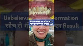 कैसे बदल सकता है जीवन एक सुंदर मुस्कुराहट के साथ Smile transformation smilemakeover newsmile [upl. by Enomed]