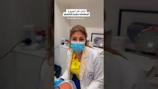 اثار الجروحازالة woundscarsremovalnebras clinic 000442023113000 للحجز00447736741700 skin p [upl. by Sherwin]