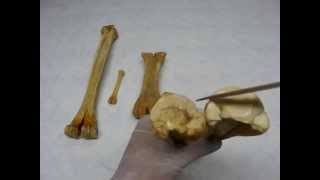 Metacarpal amp Metatarsal bones by dr khaled shoghy [upl. by Nadruoj]