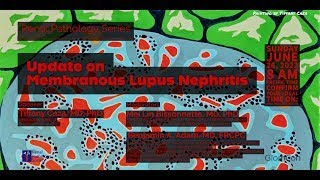 Update on Membranous Lupus Nephritis [upl. by Darleen199]