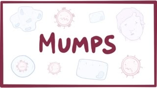 Mumps  symptoms diagnosis treatment pathology [upl. by Ramled820]