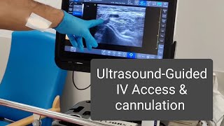 UltrasoundGuided IV Accesscannulation Annotated version [upl. by Clarissa]