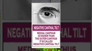 What is a Negative Canthal Tilt  shorts shitposting [upl. by Morrissey]